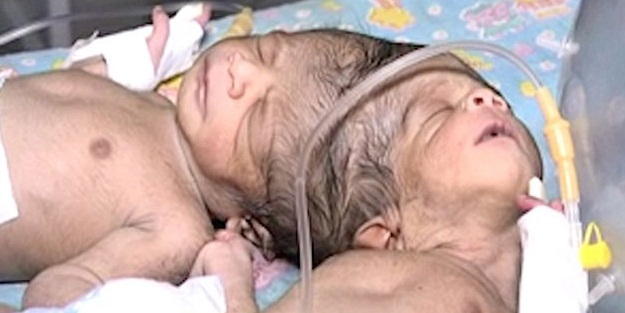 Aynı beyni paylaşıyorlar