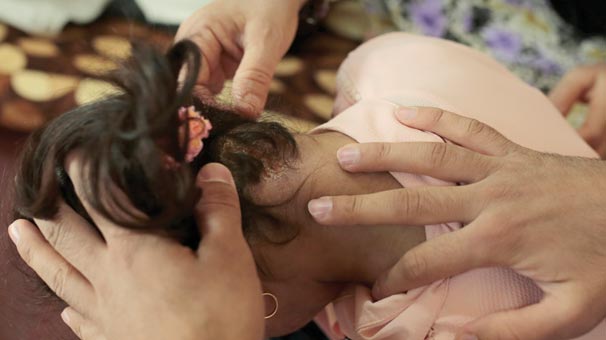 Aynı hastalıktan kardeşini kaybetti! 13 yaşındaki genç kız...