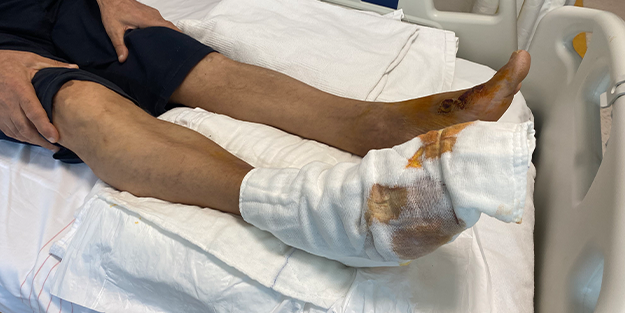 Az daha ayağını kaybediyordu! Bu ürünü kullananlar dikkat!