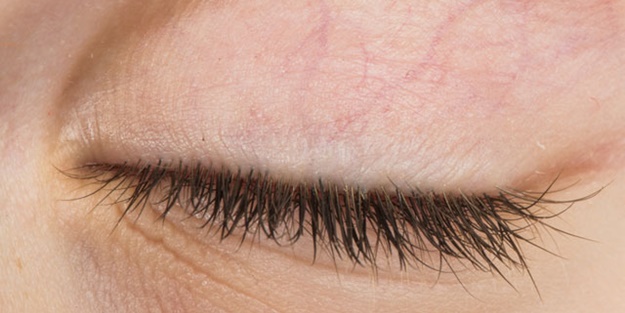 Az görmenin sebebi ne?