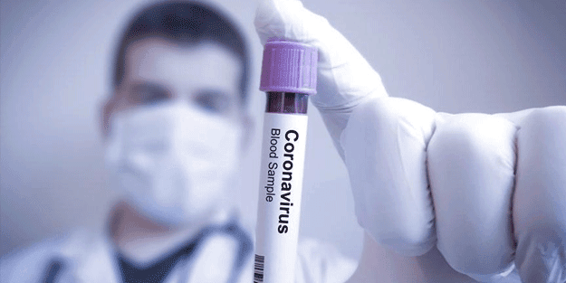 Azerbaycan'da korona vakalarında artış... İşte son rakamlar