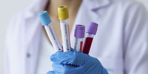 Azerbaycan'da koronavirüs vaka sayısı artıyor