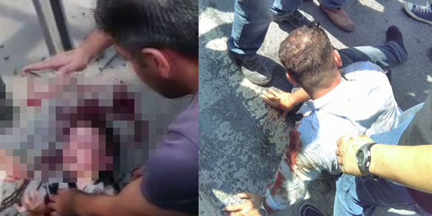 Babasından dayak yiyen çocuktan kötü haber!