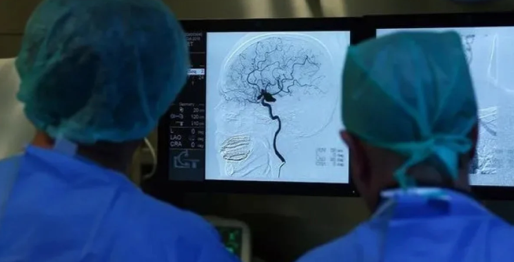 Bacağı ağrıyordu beyninin yarısının olmadığı ortaya çıktı