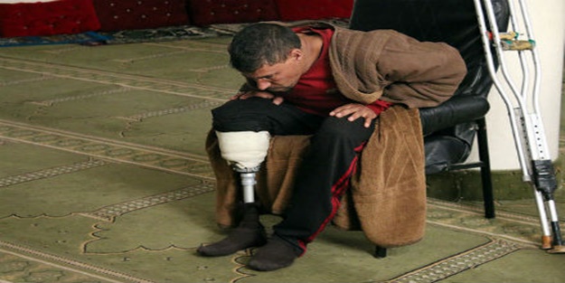 Bacağını kaybeden Suriye'li imam görevinden vazgeçmedi