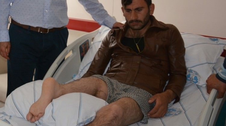 Bacağını ters diktiler!