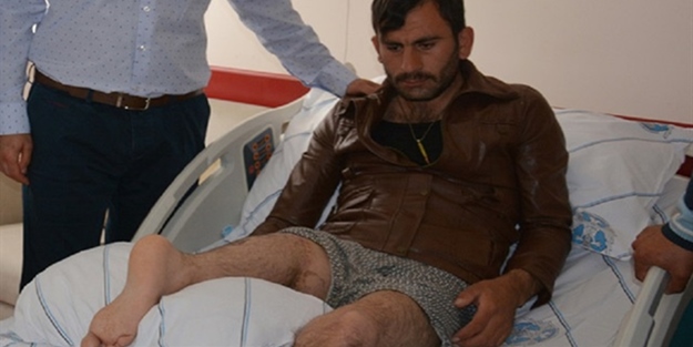 Bacağını ters diktiler