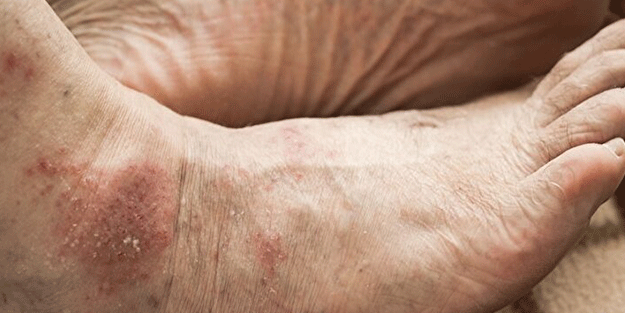 Bacak ağrısı yaşıyorsanız bu haber tam size göre!