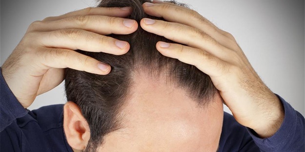 Badem saç dökülmelerini önlüyor