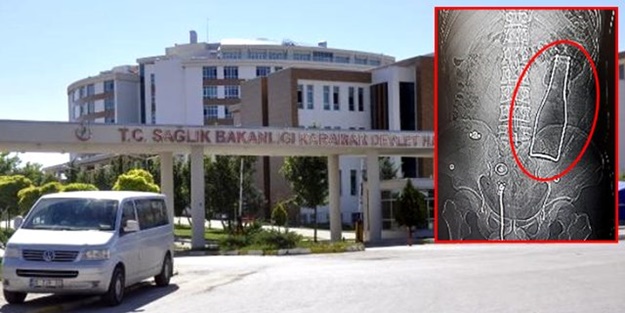 Bağırsağından şişe çıkan gençten açıklama: Duş alırken yanlışlıkla oldu