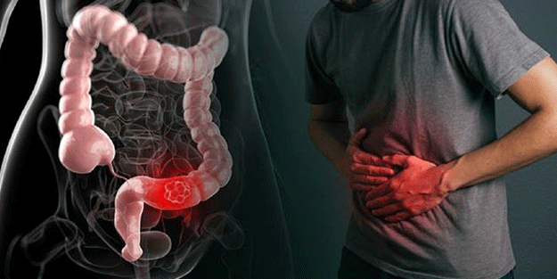 Bağırsakları canavar gibi çalıştıran besinler! Saniyesinde kabızlığa şifa oluyor