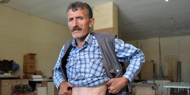 Bağırsaklarını torbada taşıyor!