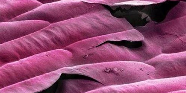 Bakalım yiyecekleri mikroskobik görüntülerinden tanıyabilecek misiniz?