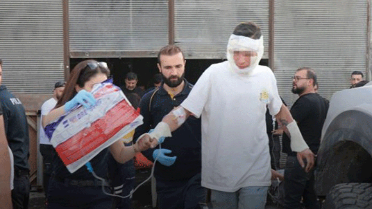 Bakım servisinde can pazarı: Sigara içmek isterken LPG'den sızan gaz patladı!