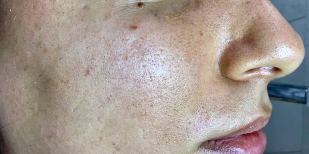 Bakımsız ciltler hem lekeleniyor hem yaşlanıyor