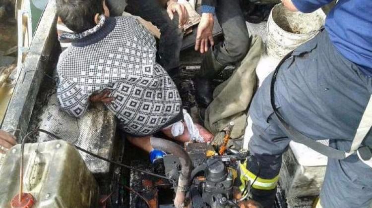 Balık merakı başına iş açtı! Bacağı parçalandı