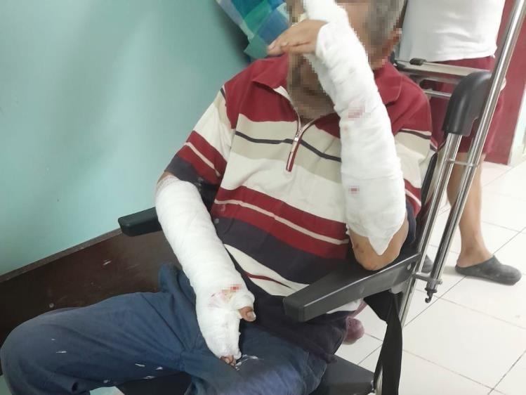 Balıkesir’de başıboş köpek dehşeti! Kollarını paramparça ettiler