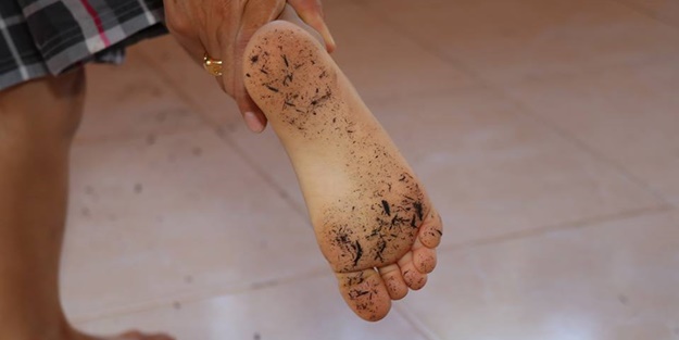 O ilimizde balkona çıkanın ayaklarının altı bu hale geliyor!