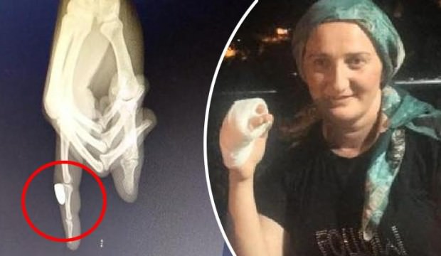 Balkonda otururken parmağına kurşun isabet etti!