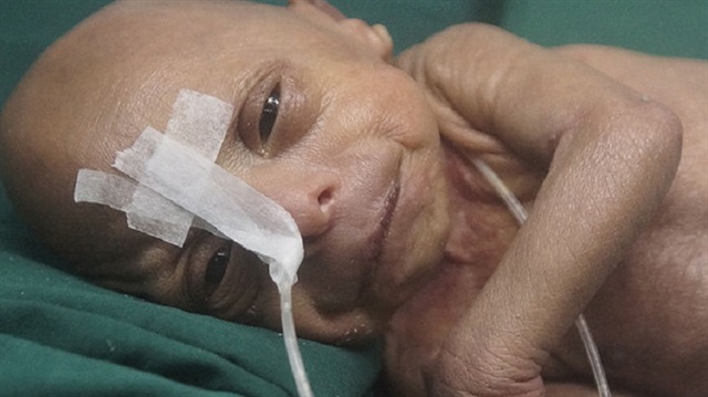 Tüm dünya bunu konuşuyor! Bebek yaşlı doğdu...