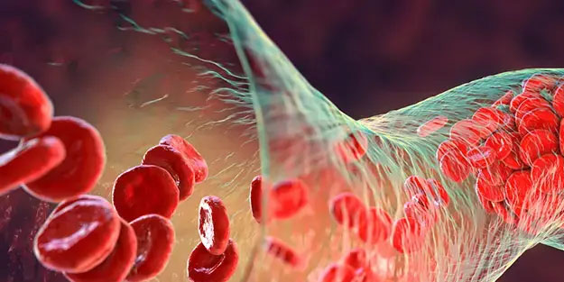 Bardak bardak içiyoruz ama damarları tıkayıp kalp krizine davetiye çıkarıyor!