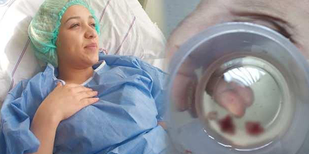 Başı ağrıdı, burnundan taş çıktı!