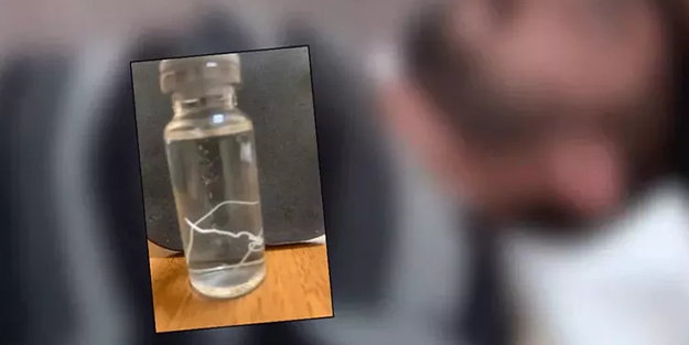 Başı ağrıyan hastanın alnından çıkan canlı yok artık dedirtti!