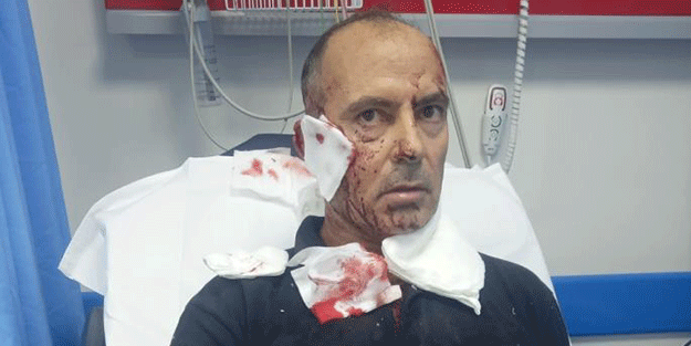 Başıboş köpeğin saldırdığı adam ağır yaralandı! 100'den fazla dikiş atıldı