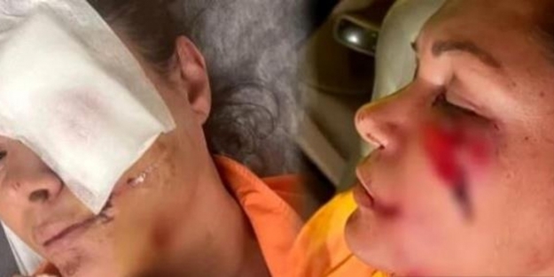 Başıboş köpek propagandası yapmıştı, kanlar içinde kaldı! Tanınmaz hale gelen ünlü isimden 'pes' dedirten açıklama