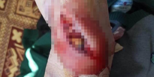 Başıboş köpek, yaşlı adamın kolunu parçaladı! Helikopterle hastaneye yetiştirildi