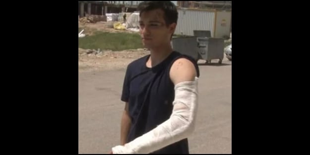 Başıboş köpekler, üniversiteli genci hastanelik etti! 1 yılda 10 kez saldırdılar