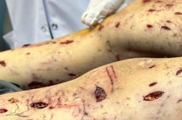 Başıboş köpeklere çare bulunması için daha ne olması gerekiyor? Vücudunda parçalanmayan yer kalmadı