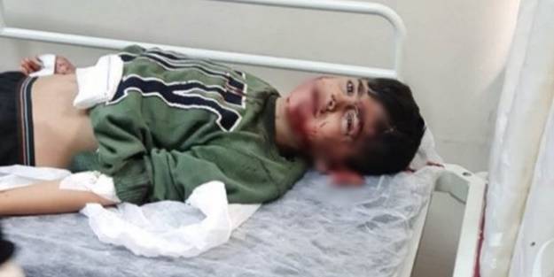 Başıboş köpeklerin 7 yaşındaki küçük Ahmet'i ağır yaralamasının ardından vatandaşlar ayağa kalktı! #KöpekleriToplayın