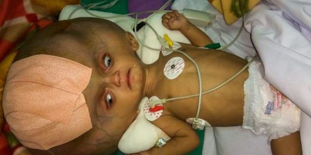 Başından 3 litre sıvı alındı