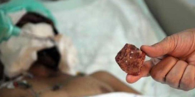 Başından çıkarıldı!