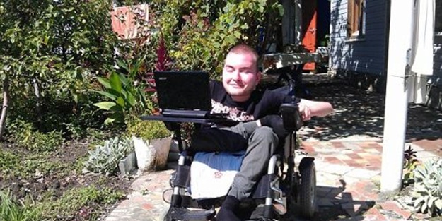 Başını kesip başka bir bedene dikecekler