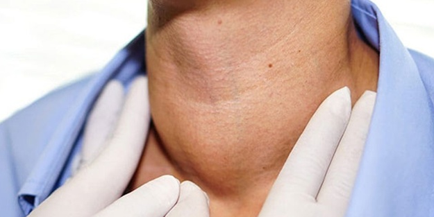 Basit bir şişkinlik Şah Damarı Tümörü olabilir!