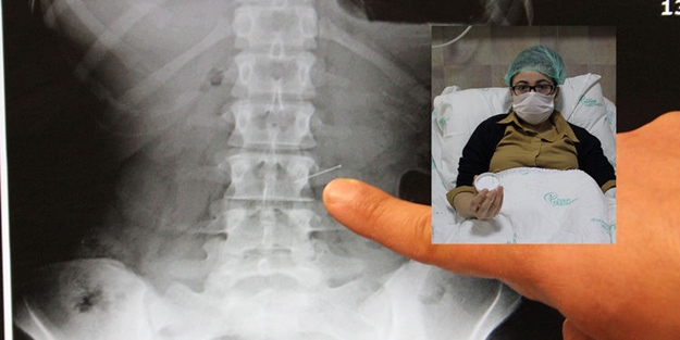 Başörtüsünü takarken iğne yuttu!