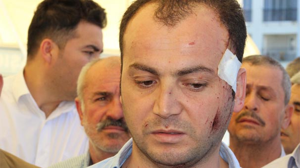 Koruması konuştu: Kuşkulu bir durum!