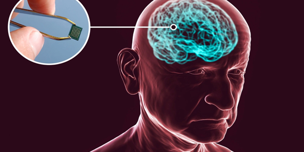 Başvurular açıldı: İnsan beynine çip yerleştiriliyor!