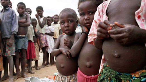 Batı ‘Kanla’ besleniyor