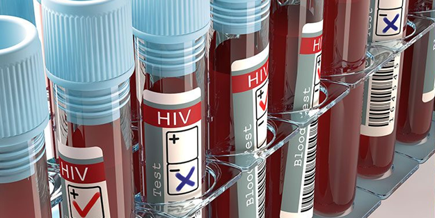 'Batıcılık' pisliğinin sonu: Türkiye’de HIV patlaması!