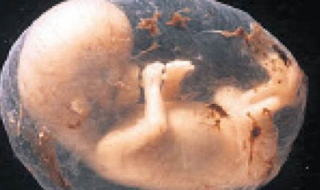 ‘Bebeğini aldırma, doğunca yedek parça yapacağız’