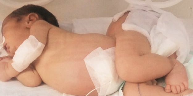 Bebekler mutasyona uğramış doğmaya başladı