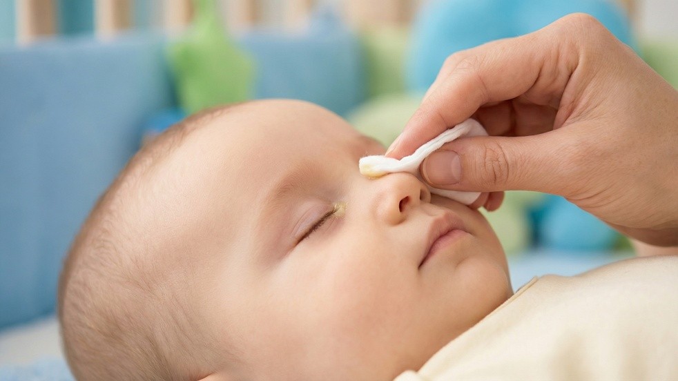 Bebeklerde göz çapaklanması neden olur, nasıl geçer?
