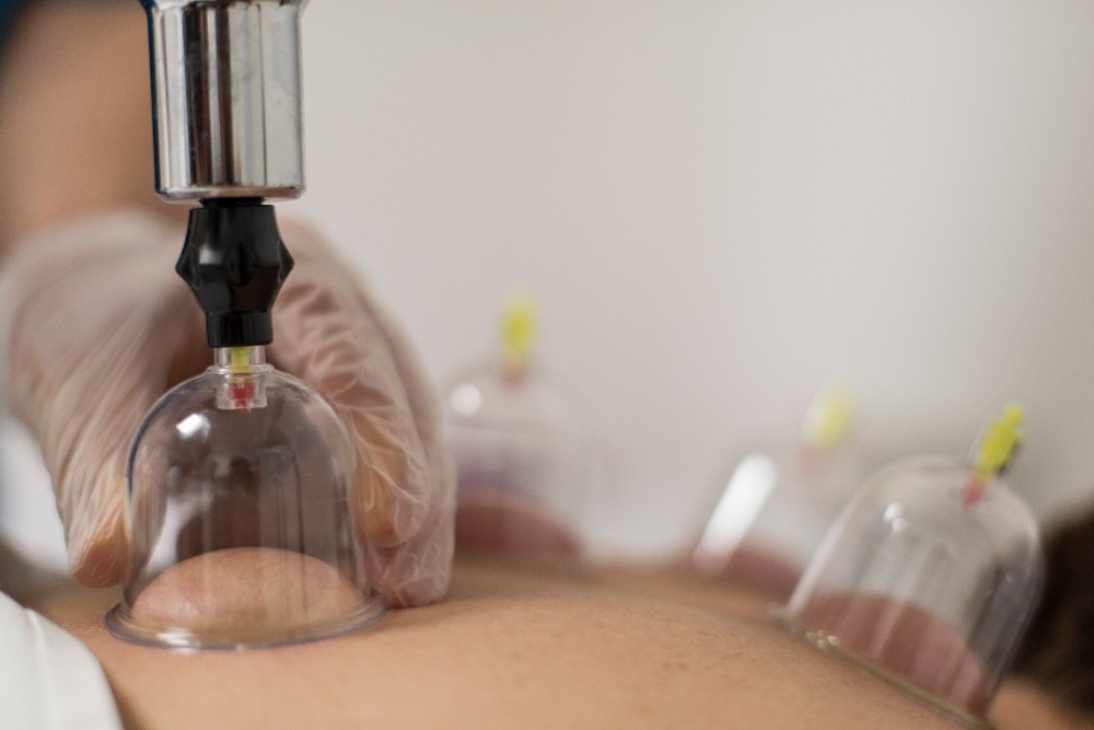 Beden saatini yeniden kurmanın anahtarı hacamat ve akupunkturda 