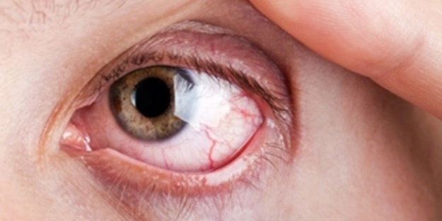 Behçet hastalığı nedir?