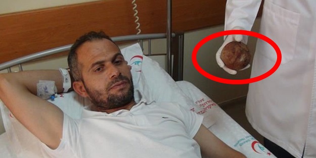 Bel ağrısı diye gitti, ama...