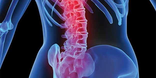 Bel fıtığı hakkında merak edilenler