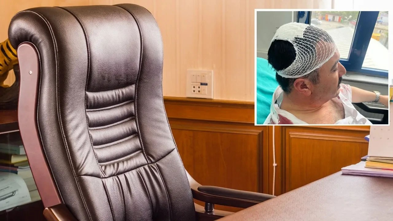  Belediye Başkan Yardımcısı'na şekerlikle saldırdı! Yeniden Refahlı yöneticiye kötü haber